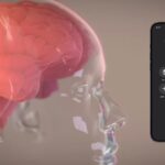 Neuralink